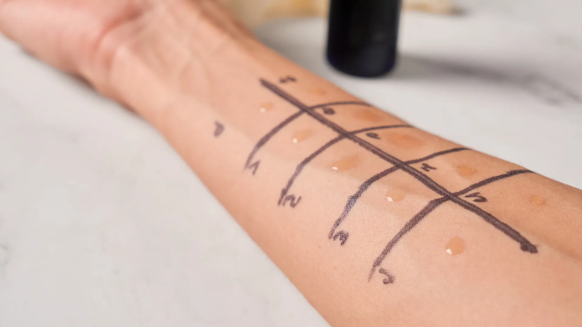 prueba de alergia en brazo