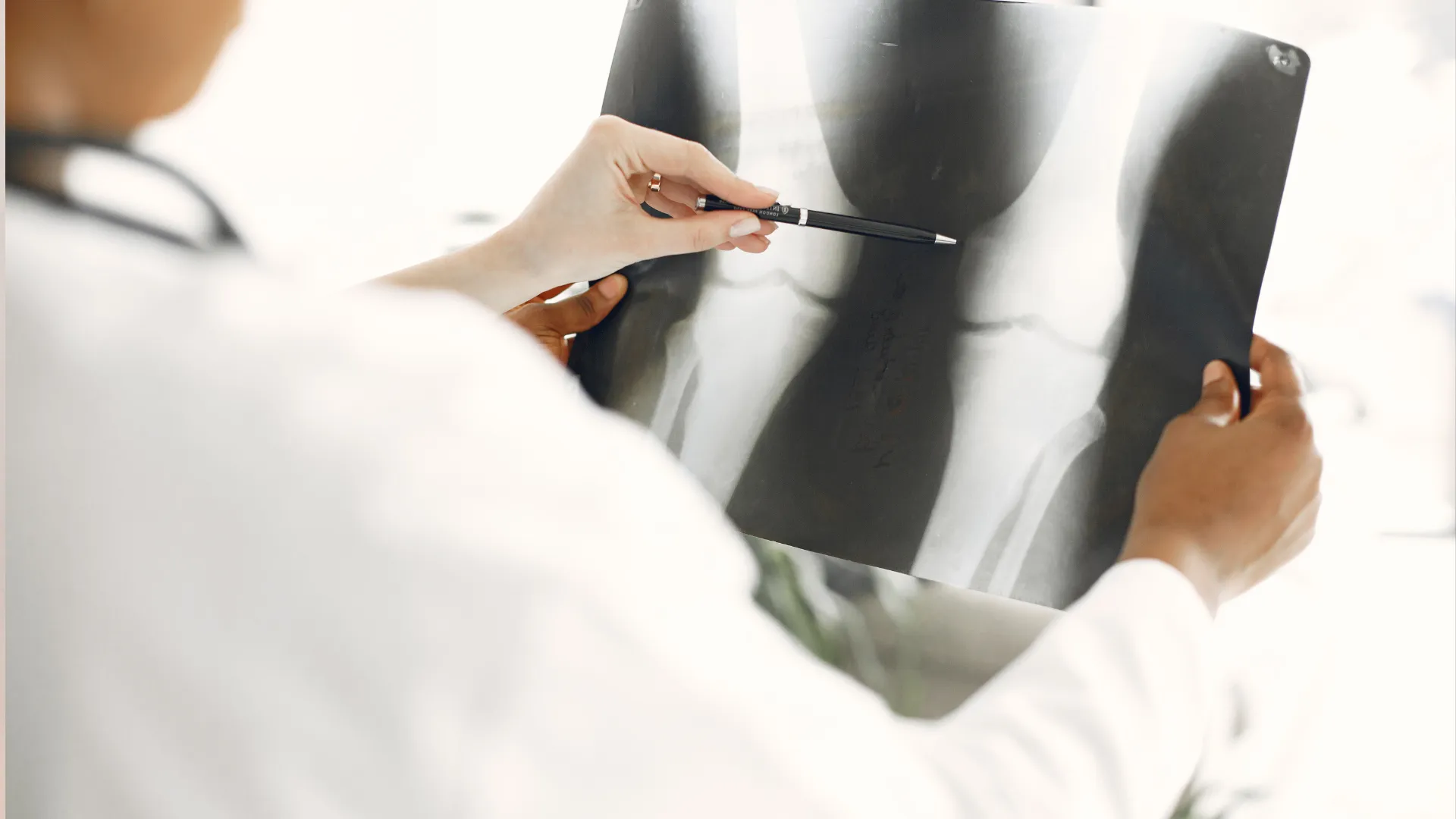 doctor sostiene una radiografia de rodilla