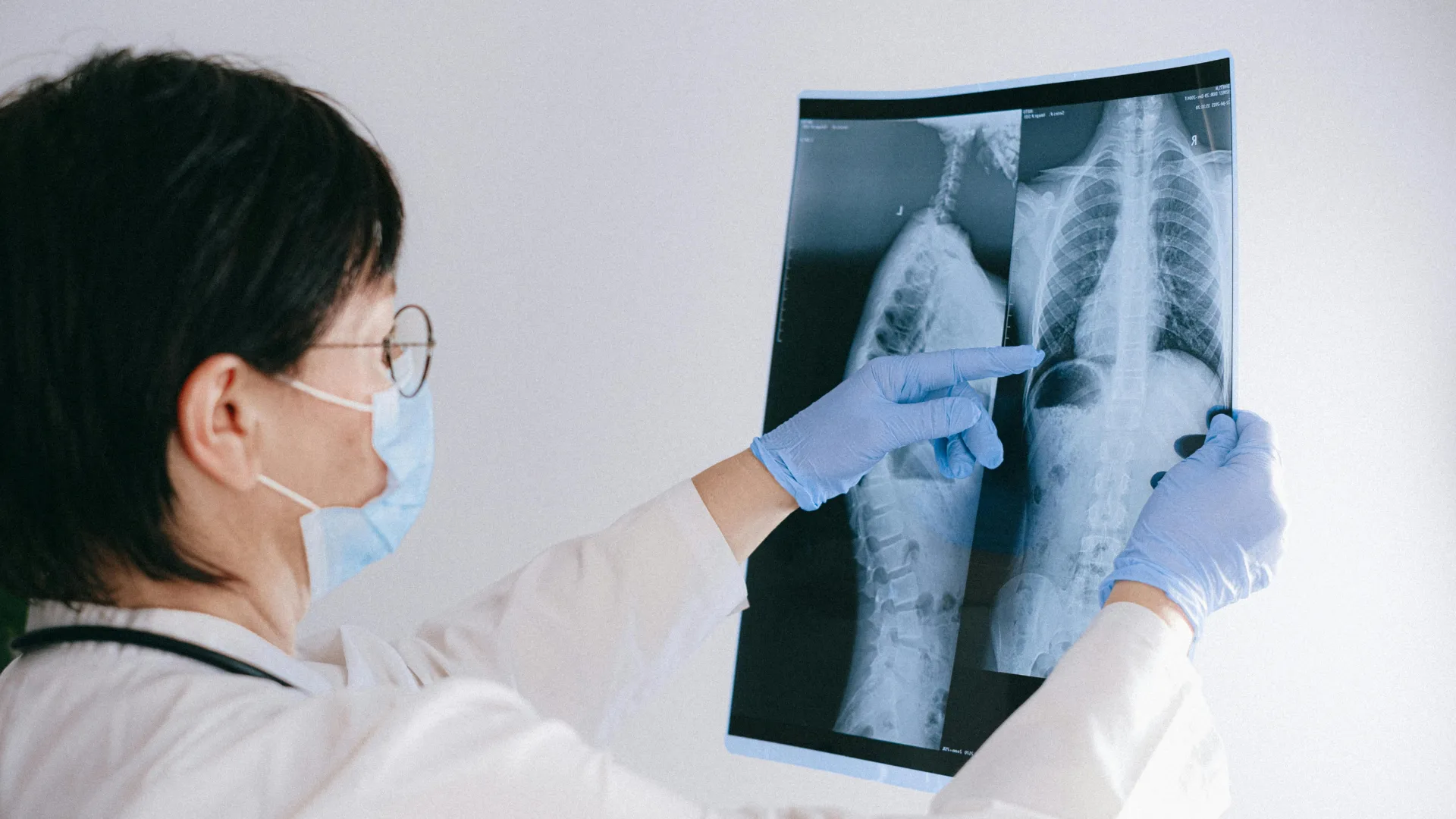 neumóloga con radiografía pulmonar