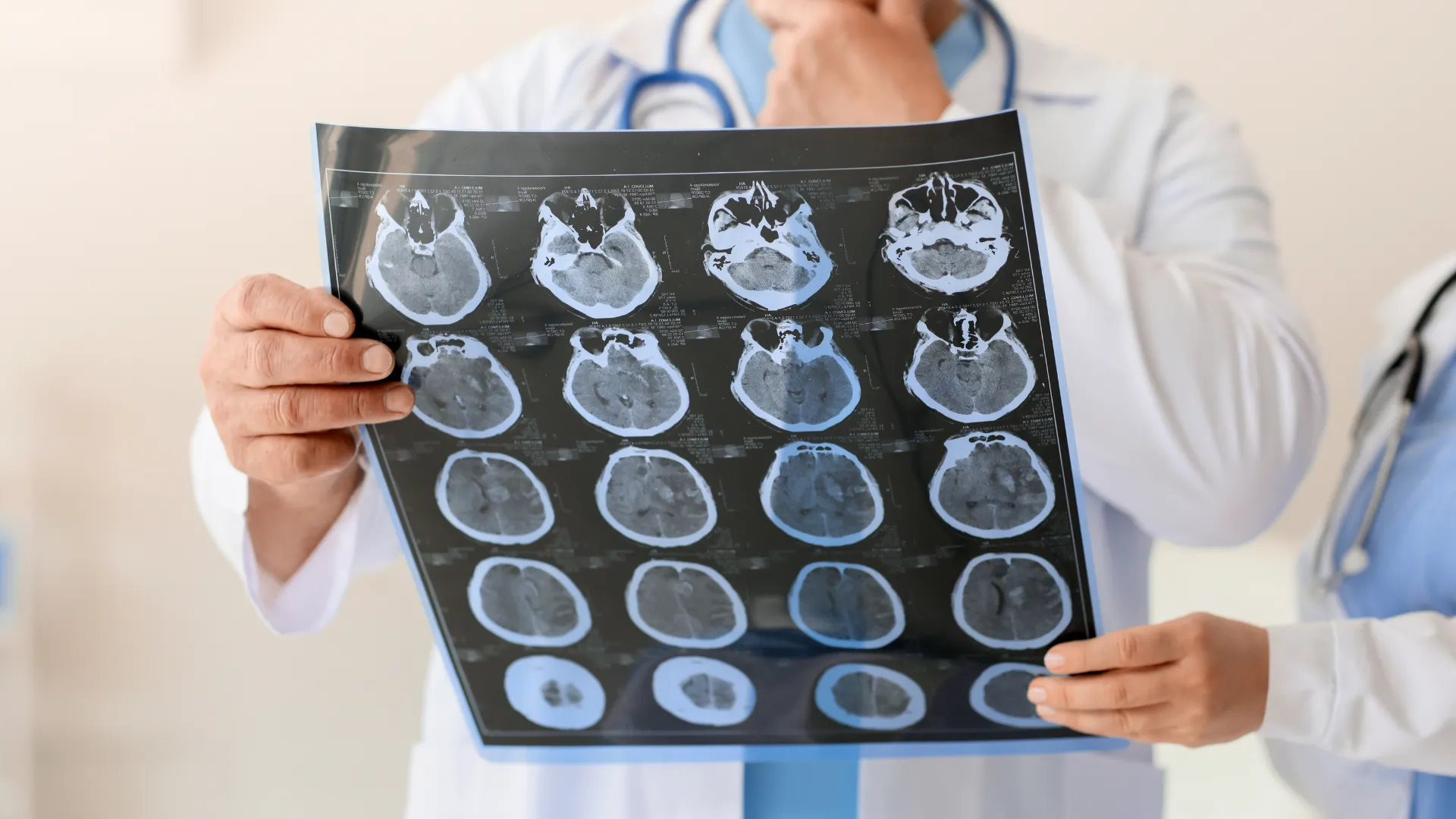 neurólogo con imágenes de escáner cerebral