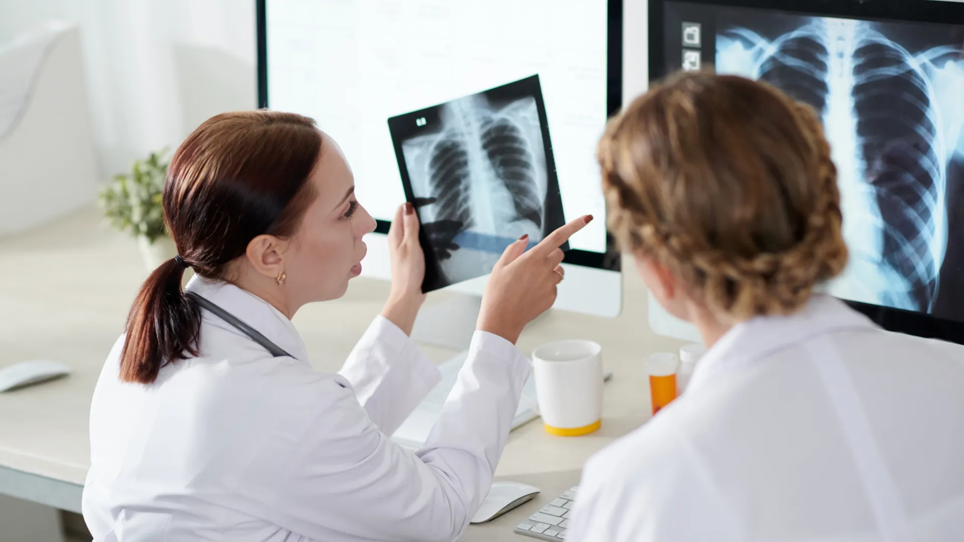 Dos profesionales sanitarios revisan una radiografía de tórax en una pantalla y en formato físico